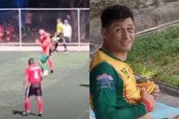 Noel Valladares terminó con el ojo inflamado y morado tras recibir un fuerte codazo en un partido de la Liga “Papi Fútbol”.