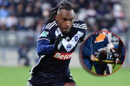 Alberth Elis se está recuperando del traumatismo craneal sufrido en un juego del Girondins Bordeaux.