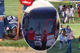 La jornada cinco de la Liga Nacional vio este miércoles tres partidos entre la tarde y noche y te mostramos las imágenes más curiosas y otras que no viste en TV donde destaca una bella kinesióloga que se integró al cuerpo técnico de UPNFM.