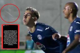 Rodrigo Auzmendi revela por qué le escupió a Julián Martínez y envía mensaje: “Yo no soy ningún racista...”