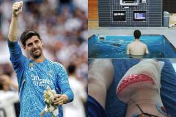 Courtois ha sido operado con éxito de su lesión de meniscos.