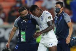 El delantero Romell Quioto no sufre rotura de músculos y si todo sale bien, podría ver acción este sábado ante México.