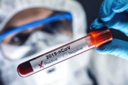 El brote de coronavirus ha provocado al menos 472.173 muertes en todo el mundo.