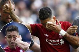 Firmino sufrió un fuerte golpe en uno de sus ojos en el partido contra el Tottenham.