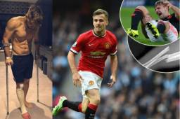 Luke Shaw es un futbolista inglés de apenas 23 años de edad. Su carrera pudo acabar en 2015.
