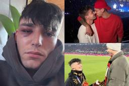 Lamentable. El árbitro alemán Pascal Kaiser le pidió matrimonio a su novio en pleno partido de la Bundesliga y una semana después ha pasado por un terrible episodio.