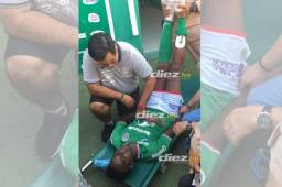 El defensa tuvo que ser atendido de emergencia en las afueras del camerino tras la victoria ante Motagua.