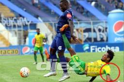 Allan Cárcamo tras chocar con Wilmer Crisanto se fue de espalda y se lesionó el brazo izquierdo. Fotos Ronald Aceituno