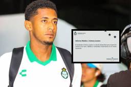 Antony Lozano estará de baja algunos días, confirma el Santos Laguna de México.