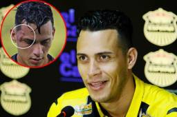 El delantero Ángel Tejeda vuelve al estadio de la polémica y dice que no le tiene rencor a la persona que lo ofendió y lo hizo reaccionar de forma violenta.