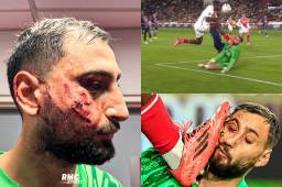 La escalofriante entrada del jugador de Mónaco a Donnarumma: el taco le quedó marcado en la cara