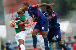 Caue Fernandes intentó rechazar un balón y terminó chocando con Eddie Hernández. El delantero del Motagua se llevó la peor parte. Foto Neptalí Romero