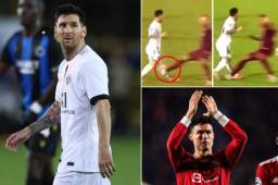 Messi tiene dañada la pierna izquierda y buscará el mismo tratamiento de Cristiano Ronaldo para solucionar el problema.