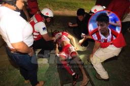 Horacio Argueta se dio a conocer en el fútbol en el Santos FC de la Liga de Ascenso.