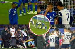 Ocupó oxigeno y los compañeros no lo creían: Jugador sufrió escalofriante golpe en la cabeza en el Leicester-Tottenham