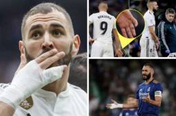 Karim Benzema siempre juega con la mano vendada en el Real Madrid y el jugador ha explicado el por qué.