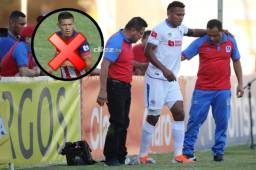 Olimpia perdió la tarde del domingo a Ever Alvarado por lesión, estará fuera al menos 6 meses.