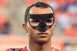 El portero del Olimpia, Donis Escober, jugará con una máscara protectora en su rostro en los partidos eliminatorios contra Estados Unidos y Costa Rica.