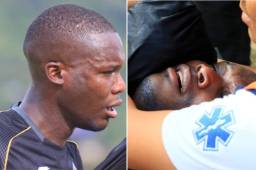 Rubilio Castillo está siendo operado de su pómulo derecho.