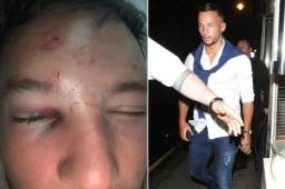 Danny Drinkwater recibió una brutal paliza por intentar ligar a la pareja de otro jugador en un club nocturno. // Fotos cortesía The Sun.