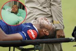 El delantero del Motagua Eddie Hernández se encuentra hospitalizado. Hoy será operado y se espera que el tiempo de recuperación no se mayor de tres semanas.