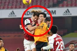 Raúl Jiménez sufre una fractura de cráneo tras su choque con David Luiz.