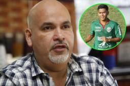 Amaya dijo que quieren renovar a Cálix por tres años.