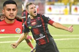 El lateral izquierdo de Costa Rica, Ronal Matarrita, se perderá por lesió el Mundial de Rusia. Lo sustituye el jugador del Alajuelense, Kenner Gutiérrez. Fotos Agencia