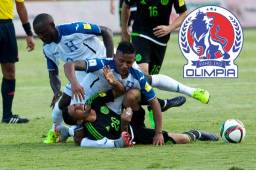 Esta fue la cruel lesión que sufrió Luis Garrido, futbolista hondureño durante un partido de eliminatoria con la Selección de Honduras frente a México.