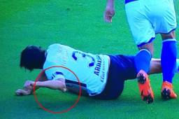 Alejandro Arribas cayó con su brazo izquierdo y tuvo que salir de cambio.