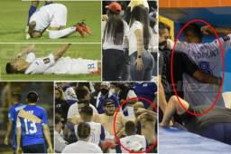 Honduras sacó un amargo punto ante una débil selección de El Salvador, pero el partido ha dejado imágenes memorables como algunos buenos salvadoreños siendo grandes anfitriones, chicas catrachas que hicieron arder el Cuscatlán y las alarmantes fotos de Edwin Rodríguez, no podía ni caminar por si solo. Fotos: Yoseph Amaya/Jefry Ayala