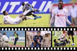 Vivimos un clásico bravo. Olimpia y Motagua jugaron sin miedo y dejó a Yustin Arboleda expulsado y a Kevin López lesionado. Diego Vázquez festejó como loco su primer triunfo ante Pedro Troglio en un clásico lleno de patadas.