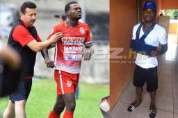 Kemsie Abbott está a la espera de los resultados de las pruebas. Dice que se tratará para superar y volver a las canchas lo más pronto posible. Foto DIEZ