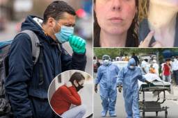 Te presentamos cuáles son los síntomas que quizá hayas ignorado, pero que en realidad se trataría del virus. Fatiga, pérdida de cabello, marcas en la piel, entre otras.