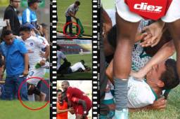 Se disputó la fecha 8 del Apertura en Honduras y estas son las imágenes curiosas que la televisión no mostró. ¿Qué quería hacer Héctor Vargas?.