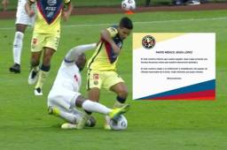 Chucho López se marchó directo al hospital donde han confirmado una fractura de peroné.