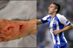 Hector Herrera salió lesionado luego del partido contra la Juventus.