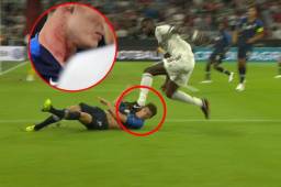 El jugador francés terminó bien afectado por el alemán.