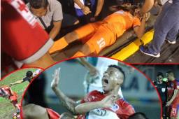 Te dejamos las imágenes más curiosas que nos ha dejado la jornada 9 del torneo Apertura 2017.