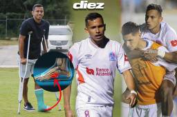 Edwin Rodríguez no volverá a las canchas para hacer trabajos con sus compañeros hasta dentro de un mes, aproximadamente. Foto Diez: Rigoberto Rivas.