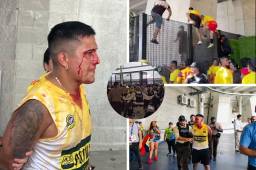 Caos, sangre y detenidos en la Copa América previo al partido de la final Colombia vs Argentina en Miami