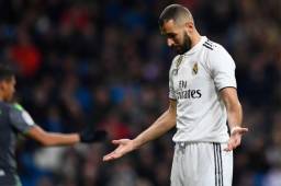 El francés Karim Benzema espera jugar el sábado con Real Madrid ante Sevilla para el domingo someterse a una operación del dedo meñique. Foto AFP