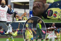 Olimpia ha sorprendido al América ganándole 0-1, pero no le ha ajustado para avanzar a cuartos de final. En medio del juego salieron muchos roces como la fuerte falta de Yustin Arboleda contra Chucho López que provocó la furia de Guillermo Ochoa.