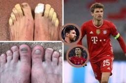 Thomas Müller, estrella del Bayern Munich, sorprendió a todos al mostrar sus pies y entra en el top de los más feos.