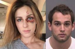 Melissa Gentz denunció al campeón de motocross Erick Bretz por agredirla por subir una foto en su Instagram.