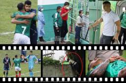 Los jugadores del Motagua se rindieron en respeto a Emilio Izaguirre, jugador emblema en la institución azul. Diego Vázquez fue captado subido en un muro afuera del Yankel y Luis Garrido salió del partido con las manos en el pecho tras un fuerte dolor. Vargas hizo otro berrinche.