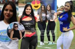 Las linduras que nos dejó la jornada 6 de la Liga Nacional de Honduras. ¡Enamórate!