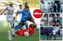 Honduras Progreso se impuso 1-0 ante Platense en el Estadio Excélsior. Estas son las fotos que captó el lente de DIEZ. Fotos Neptalí Romero