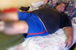 Rafael 'Paciencia' Núñez se encuentra postrado en cama y urge de la ayuda de todos para que no le amputen las piernas. Foto Cortesía