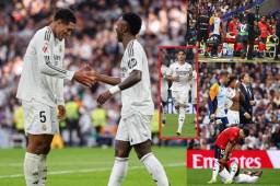 El Real Madrid volvió al triunfo este sábado, pero encendió las alarmas con tres de sus jugadores en el primer tiempo.